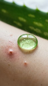 Aloe Vera Drop