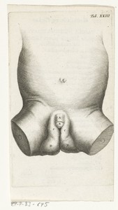 Anatomische afbeelding van de penis van een kind