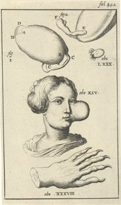 Anatomische afbeelding XI