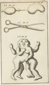 Anatomische afbeelding XV