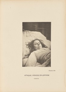 Attaque; Période Épileptoïde Stertor