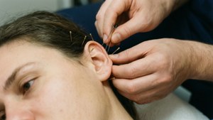 Auricular Acupuncture Treatment