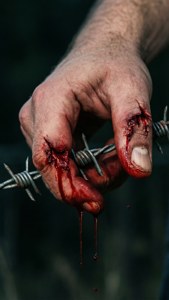 Barbed Wire Injury