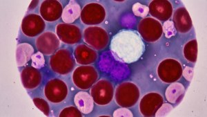 Blood Smear Stain