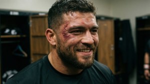 Bruised Smile