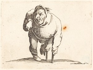 Cripple with Crutch and Wooden Leg