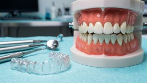 Dental Model Aligner