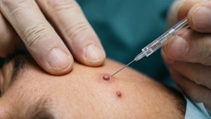 Dermatologist Lancing