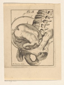 Dwarsligging van een foetus