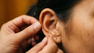 Ear Acupuncture Close-Up