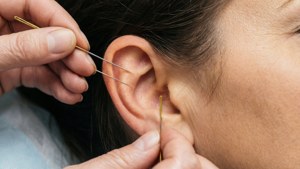 Ear Acupuncture Macro