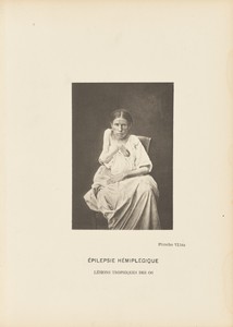 Épilepsie Hémiplégique Lésions Trophiques des Os