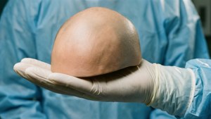 Gloved Hand Holding Bald Cap