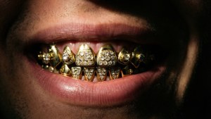 Gold Grillz Close-Up