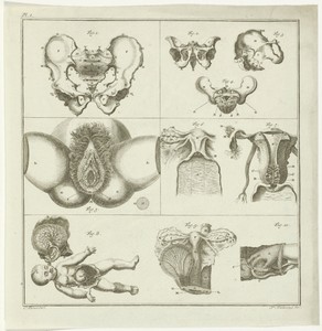 Gynaecologische voorstellingen