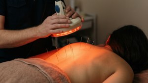 Heat Lamp Acupuncture