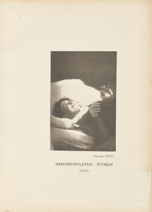 Hystéro-Épilepsie: Attaque Délire