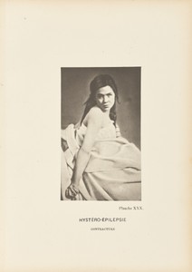 Hystero-Epilepsy Contraction