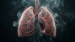 Misty Smoke Lungs