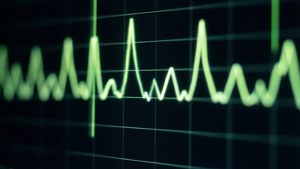 Monitor Heartbeat
