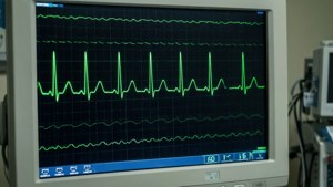 Monitor Trace