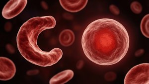 Sickle Cell Contrast