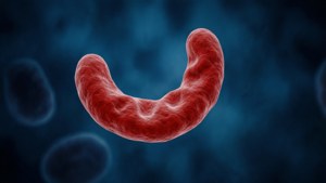 Sickle Cell Crisis