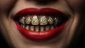Sparkling Gold Grillz Close-Up