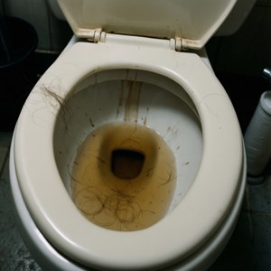 Stained Toilet Bowl