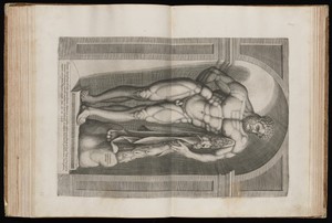 The Farnese Hercules