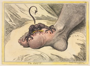 The Gout